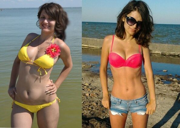 Chaill Anna 10 kg le NexaSlim